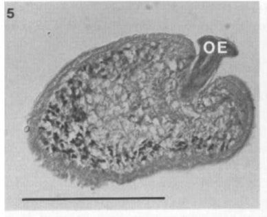 Image of Carcinonemertes pinnotheridophila McDermott & Gibson 1993