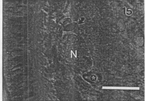 Image of Carcinonemertes regicides Shields, Wickham & Kuris 1989