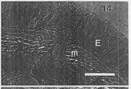 Image of Carcinonemertes regicides Shields, Wickham & Kuris 1989