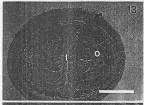 Image of Carcinonemertes regicides Shields, Wickham & Kuris 1989