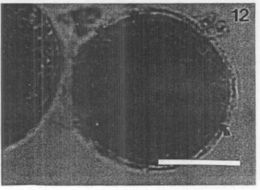 Image of Carcinonemertes regicides Shields, Wickham & Kuris 1989