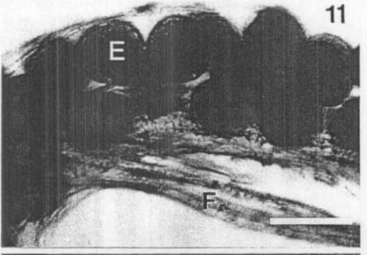 Image of Carcinonemertes regicides Shields, Wickham & Kuris 1989