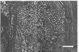 Image of Carcinonemertes regicides Shields, Wickham & Kuris 1989