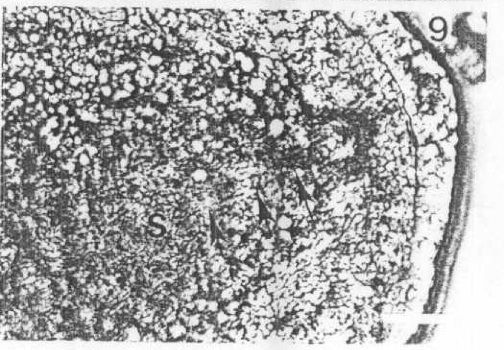 Image of Carcinonemertes regicides Shields, Wickham & Kuris 1989