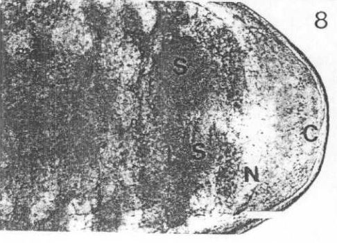 Image of Carcinonemertes regicides Shields, Wickham & Kuris 1989