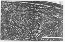 Image of Carcinonemertes regicides Shields, Wickham & Kuris 1989