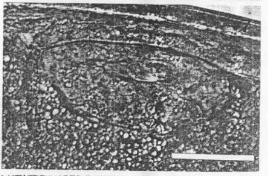 Image of Carcinonemertes regicides Shields, Wickham & Kuris 1989