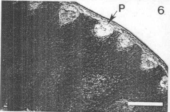 Image of Carcinonemertes regicides Shields, Wickham & Kuris 1989