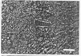 Image of Carcinonemertes regicides Shields, Wickham & Kuris 1989