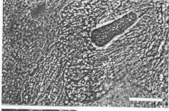 Image of Carcinonemertes regicides Shields, Wickham & Kuris 1989