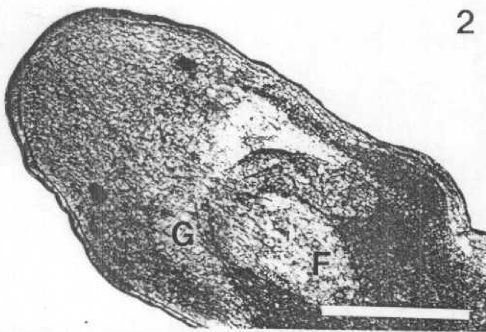 Image of Carcinonemertes regicides Shields, Wickham & Kuris 1989