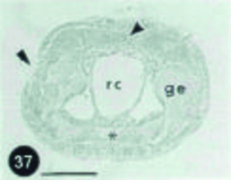 Image of Hubrechtella ehrenbergi Senz 2000