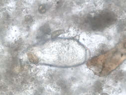 Image of Schistosoma mansoni