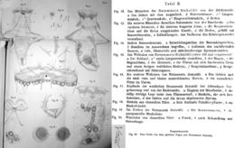 Image of <i>Asplanchna sieboldii</i>