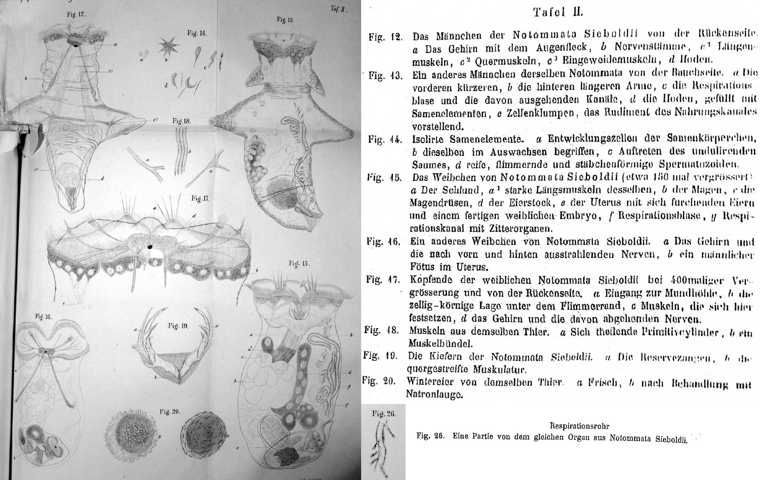 Image of <i>Asplanchna sieboldii</i>