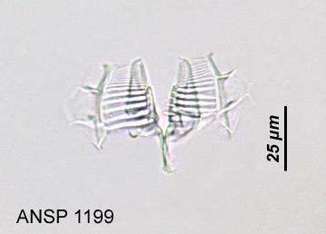 Imagem de Conochilus (Conochiloides) natans (Seligo 1900)