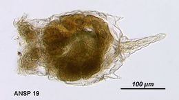 Image of Epiphanes brachionus spinosa (Rousselet 1837)