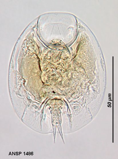 Image of Lepadella (Lepadella) apsida Harring 1916