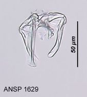 Image of <i>Notommata allantois</i>