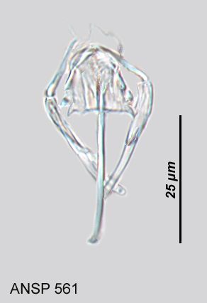 Image of <i>Notommata doneta</i>