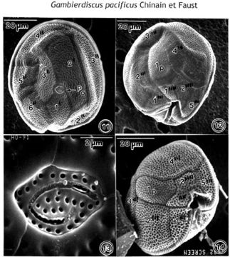 Image of Gambierdiscus pacificus