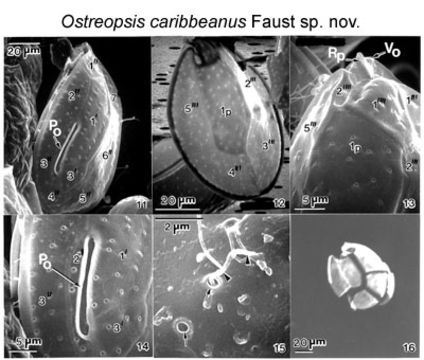 Image of <i>Ostreopsis caribbeanus</i>