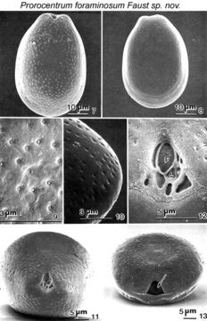 Image of Prorocentrum foraminosum