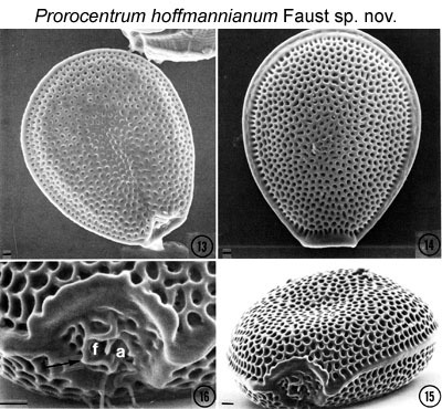 Image of Prorocentrum hoffmannianum