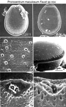 Image of Prorocentrum maculosum