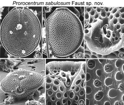 Image of Prorocentrum sabulosum M. A. Faust 1994