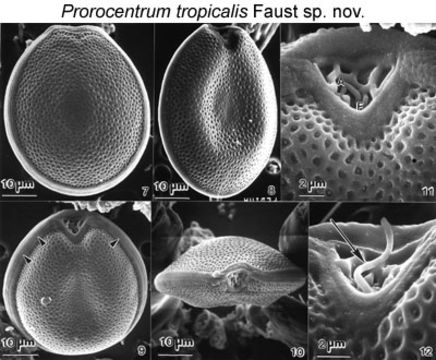 Plancia ëd <i>Prorocentrum tropicalis</i>