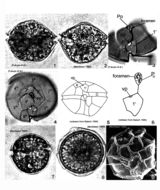 Plancia ëd Alexandrium pseudogonyaulax