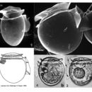 Image of <i>Dinophysis rotundata</i>