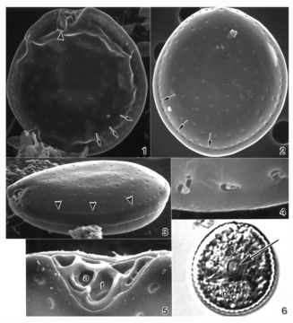 Image of Prorocentrum arenarium