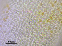 Image of turgid aulacomnium moss