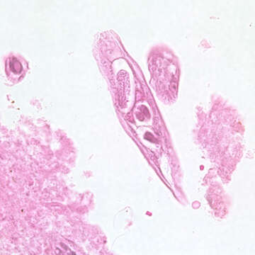 Image of Capillaria philippinensis