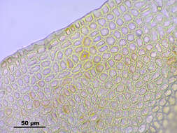 Image of turgid aulacomnium moss