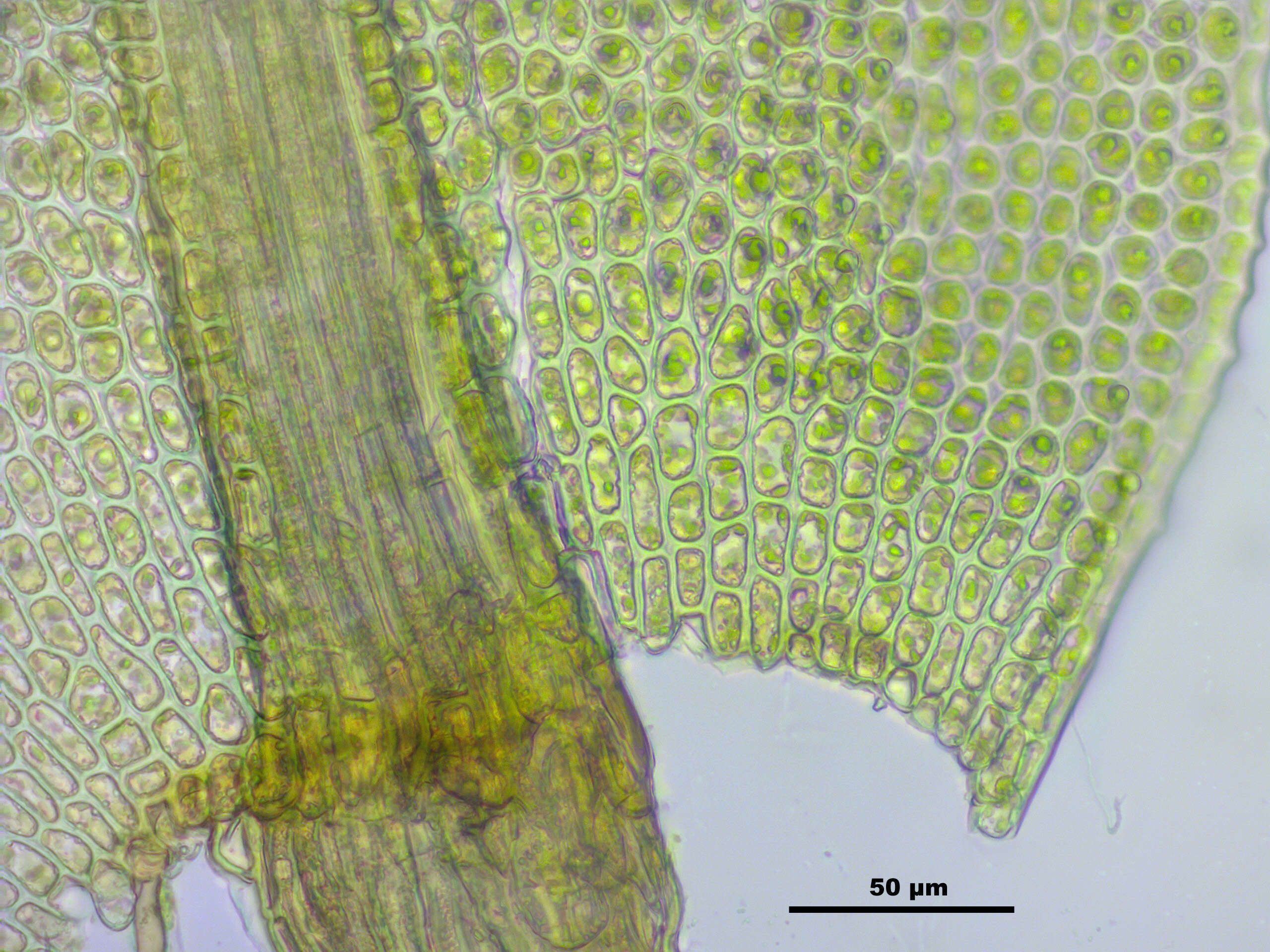 Image of aulacomnium moss