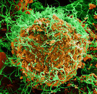 Image of Zaire ebolavirus