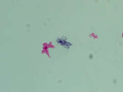 Image of Amoebidae