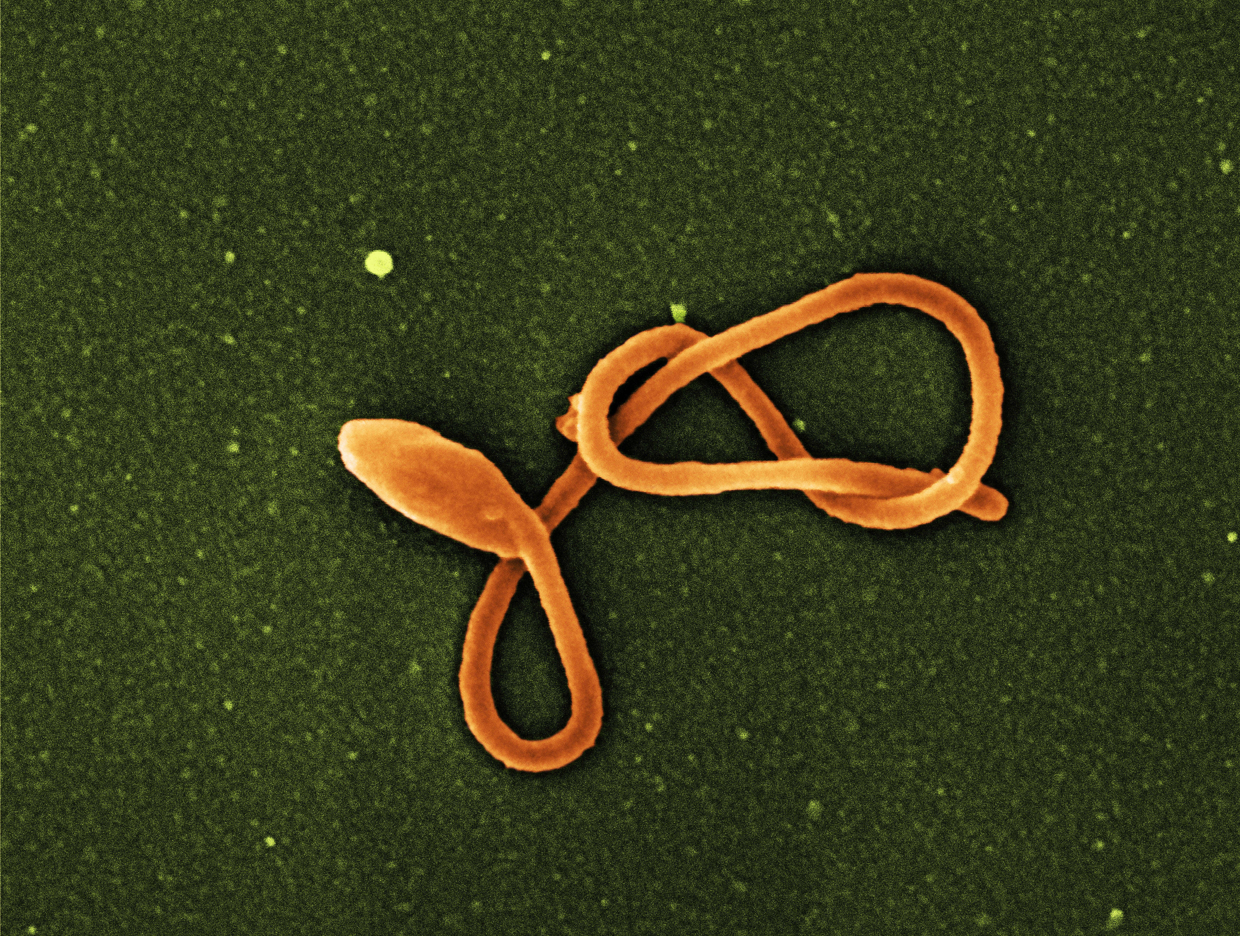 Image of Zaire ebolavirus