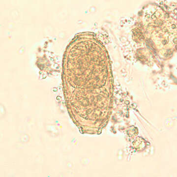 Image of Capillaria philippinensis