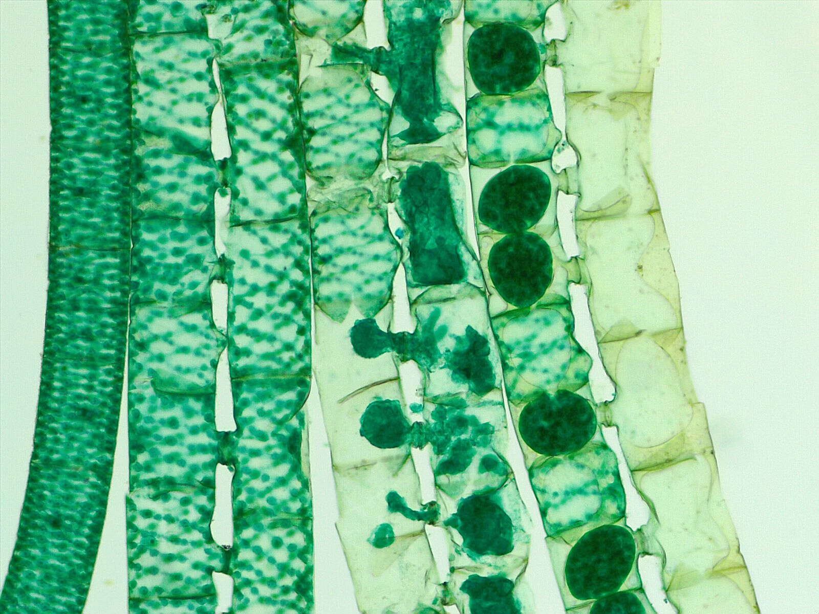 Image of Spirogyra Link 1820