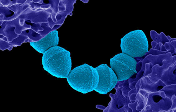 Image of Streptococcus pyogenes