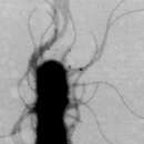 Image of Achromobacter piechaudii