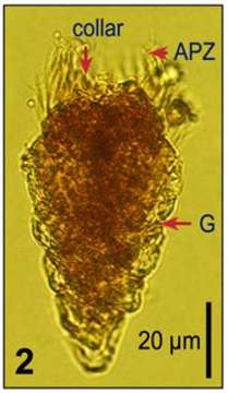 Image of Strombidium strobilum Lohmann 1908