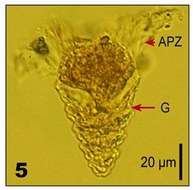 Image of Strombidium strobilum Lohmann 1908