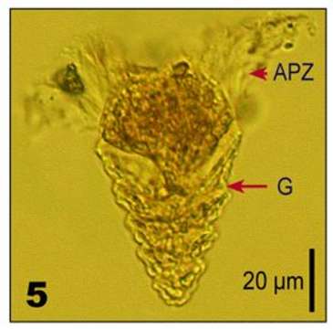 Image of Strombidium strobilum Lohmann 1908