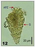 Imagem de Strombidium strobilum Lohmann 1908