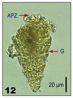 Image of Strombidium strobilum Lohmann 1908